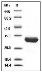 Human SCGN / Secretagogin Protein (His Tag) SDS-PAGE