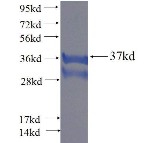 Recombinant human TIMM13 SDS-PAGE