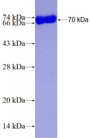 Recombinant Human ATG4B SDS-PAGE