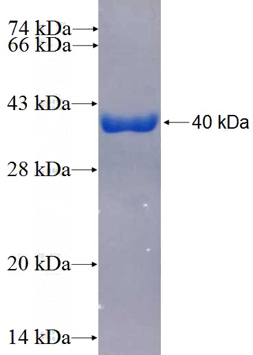 Recombinant Human RAB34 SDS-PAGE