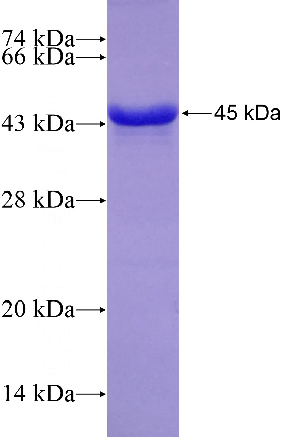 Recombinant Human DCPS SDS-PAGE