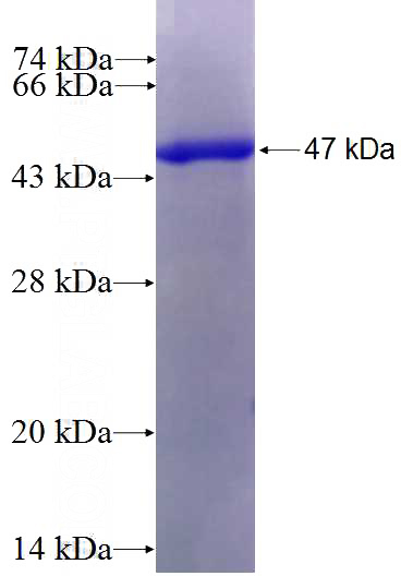 Recombinant Human RAP2A SDS-PAGE
