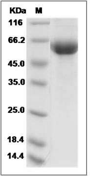 Canine GFRA1 / GFR alpha-1 Protein (His Tag) SDS-PAGE