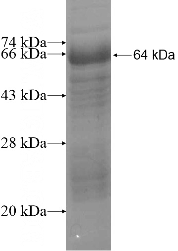 Recombinant Human ZNF597 SDS-PAGE