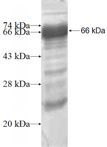 Recombinant Human TIMELESS SDS-PAGE