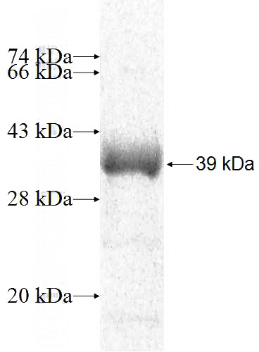 Recombinant Human NMRAL1 SDS-PAGE