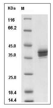 Rat CADM3 / NECL1 / IGSF4B Protein (His Tag) SDS-PAGE