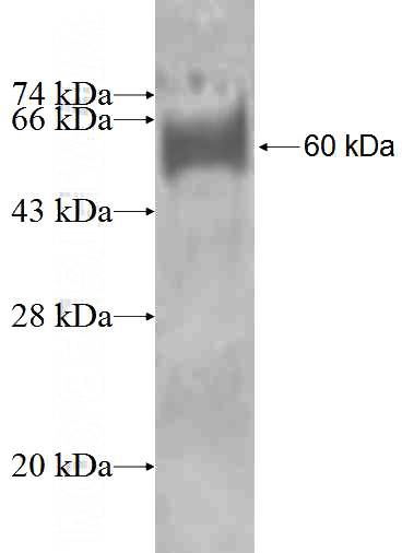 Recombinant Human CRLF3 SDS-PAGE