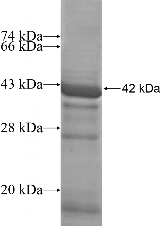 Recombinant Human EMILIN3 SDS-PAGE