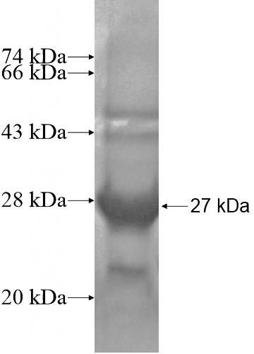 Recombinant Human RHOD SDS-PAGE