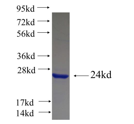 Recombinant Arabidopsis thaliana RPT1 SDS-PAGE