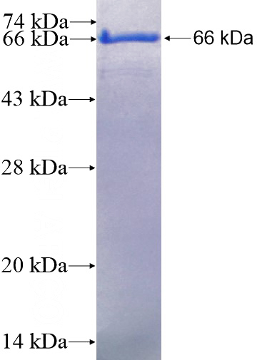 Recombinant Human CCDC93 SDS-PAGE
