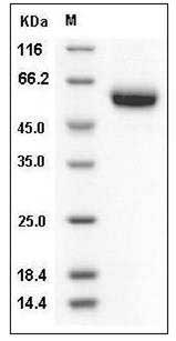 Human Osteoprotegerin / TNFRSF11B Protein (His Tag) SDS-PAGE