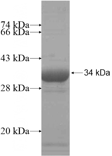 Recombinant Human LRRC61 SDS-PAGE