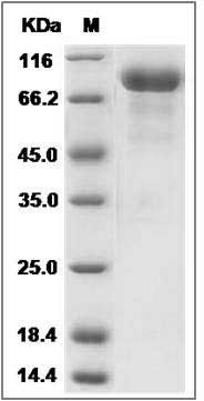 Human SLITRK6 Protein (His Tag) SDS-PAGE