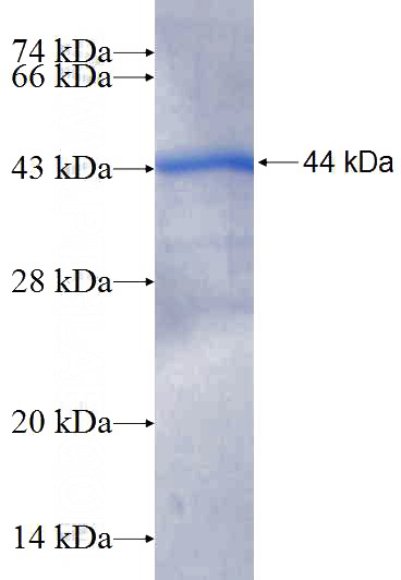 Recombinant Human PLA2G4C SDS-PAGE