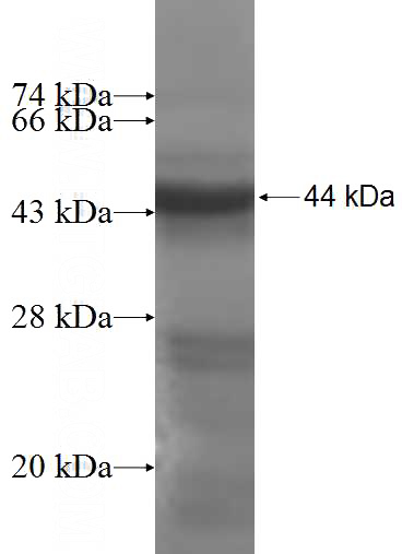Recombinant Human PNPLA6 SDS-PAGE