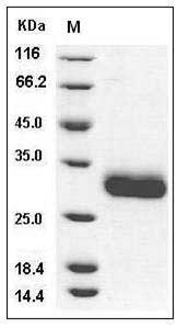 Human CXCL1 / MGSA / NAP-3 Protein (His & SUMO Tag) SDS-PAGE