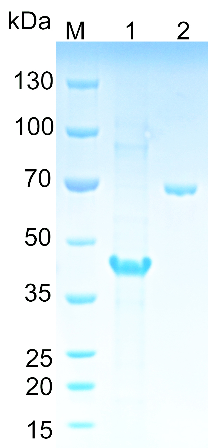 Recombinant human TEX264 SDS-PAGE