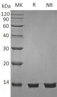 Human B2M/CDABP0092/HDCMA22P (His tag) recombinant protein
