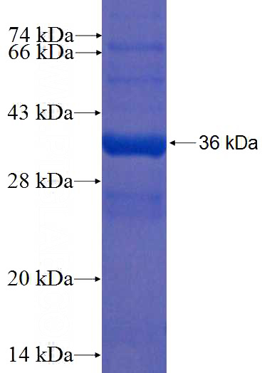 Recombinant Human YPEL5 SDS-PAGE