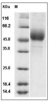Rat Ninjurin-1 / NINJ1 Protein (Fc Tag) SDS-PAGE