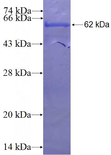 Recombinant Human WDR69 SDS-PAGE