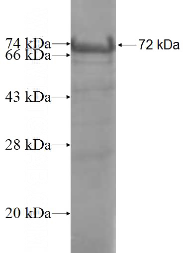 Recombinant Human SILV SDS-PAGE