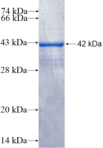 Recombinant Human RPL13 SDS-PAGE