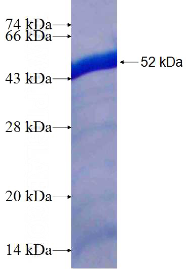 Recombinant Human HMBOX1 SDS-PAGE