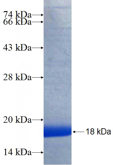 Recombinant Human VHL SDS-PAGE