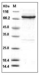 Human RET Kinase Protein (aa 658-1114, His & GST Tag) SDS-PAGE
