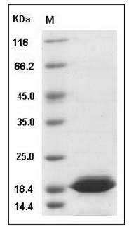 Human Dim2 / TXNL4B Protein (His Tag) SDS-PAGE
