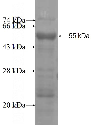 Recombinant Human SLC26A3 SDS-PAGE