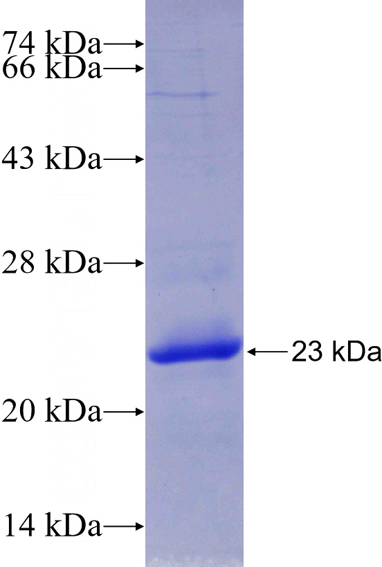 Recombinant Human RPL23A SDS-PAGE