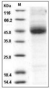 Mouse CD1D / R3G1 Protein (His Tag) SDS-PAGE