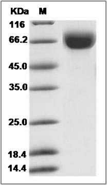 Human LILRB1 / CD85 / ILT2 / ILR1 Protein (His Tag) SDS-PAGE