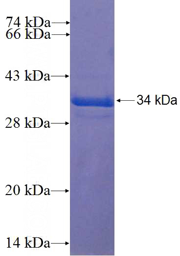 Recombinant Human FAM9B SDS-PAGE