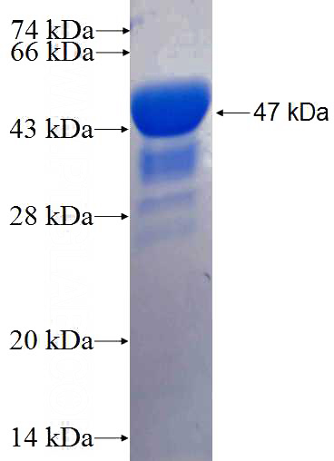 Recombinant Human CRB1 SDS-PAGE