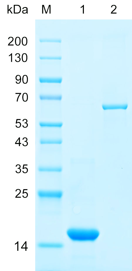 Recombinant RIFK protein (His tag) SDS-PAGE