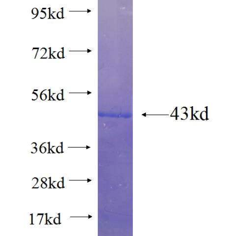 Recombinant human PRL3(Full length) SDS-PAGE