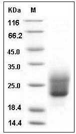 Human NCR3 / NKp300 Protein (His Tag) SDS-PAGE