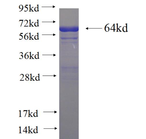 Recombinant human AXIN1 SDS-PAGE