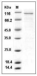Human CAMK4 / CaMKIV Protein (GST Tag) SDS-PAGE
