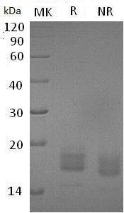 Human TIGIT/VSIG9/VSTM3 (His tag) recombinant protein