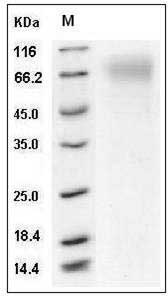 Mouse SCARB1 / CD36L1 / CLA-1 Protein (His Tag) SDS-PAGE