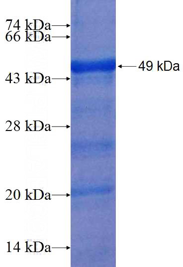 Recombinant Human REPS1 SDS-PAGE