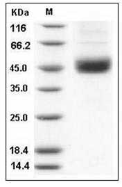 Human SMYD2 / KMT3C Protein (His Tag) SDS-PAGE