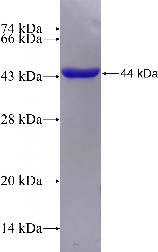 Recombinant Human LAMB1 SDS-PAGE