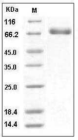 Human EphB4 / HTK Protein (His Tag) SDS-PAGE